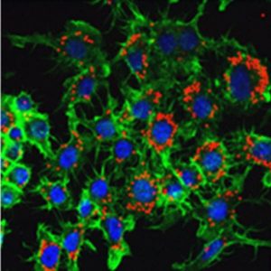 nanoparticles in cells