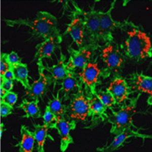 nanoparticles in cells