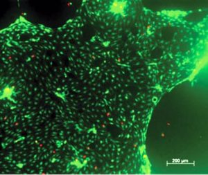 printable biocompatible polyacrylate network