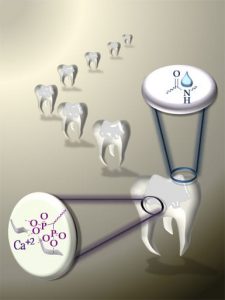 New dental adhesives containing bisphosphonates or a bisphosponic acids.