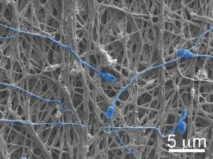 Fibers and sperm