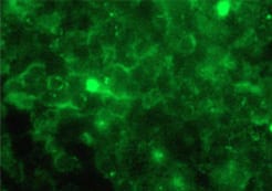 Fluorescence images of transfected HeLa cells