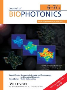 Optoacoustic Imaging and Spectroscopy for Biomedical Diagnosis