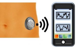 Tissue Implantable Insulin Sensor