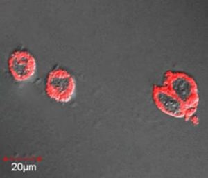 lanthanide-nanoprobes