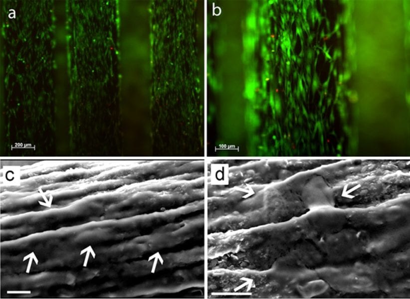 Myoblast cells growing on graphene-PLGA fibers