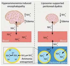 lipsome-supported-peritoneal-dialysis