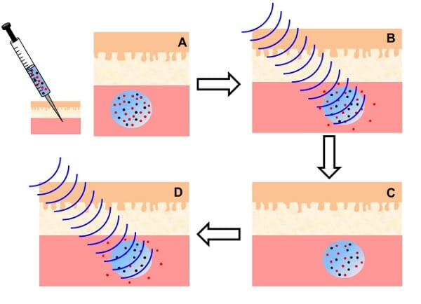 Remote controlled nanoparticles