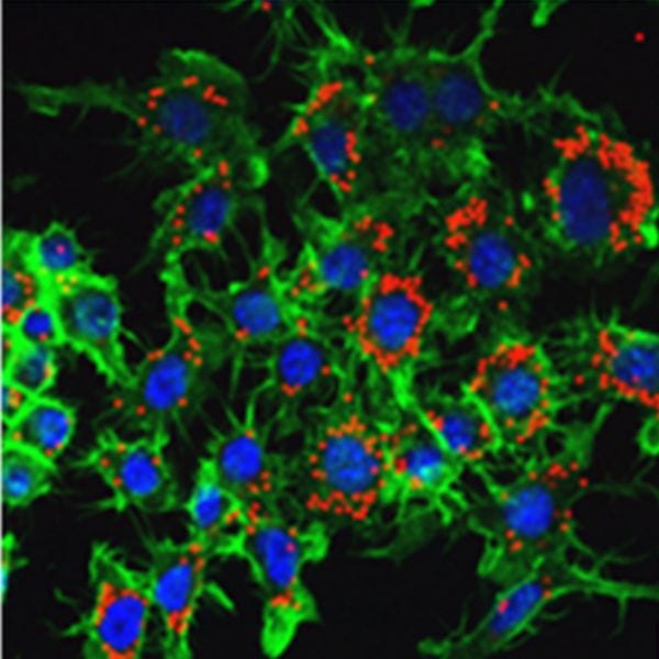 nanoparticles in cells