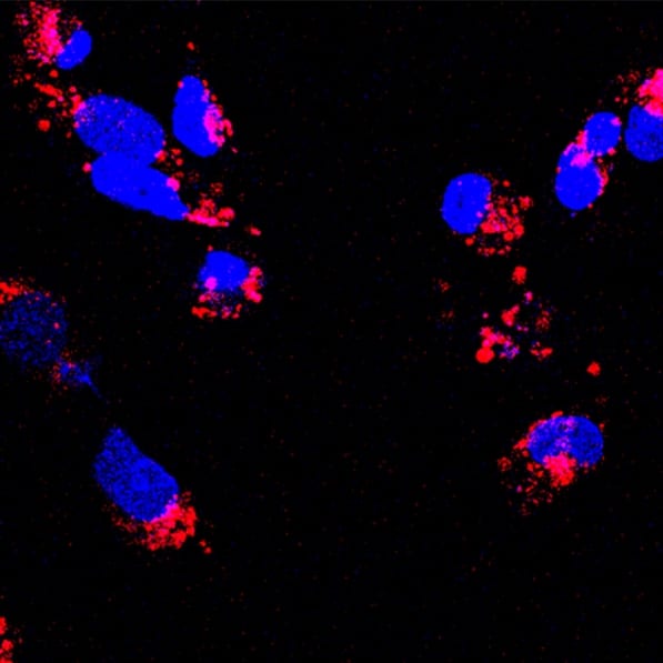 Designing Nanomaterials for Drug Delivery