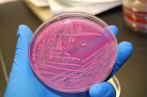 New disinfectants to fight E. coli