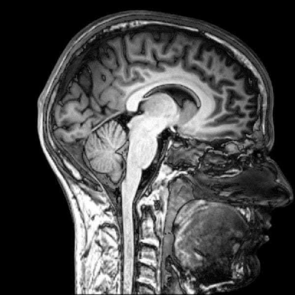 Comparing MRI Contrasts