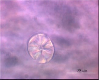 LiNbO3-silica glass ceramics: a promising alternative for frequency conversion?