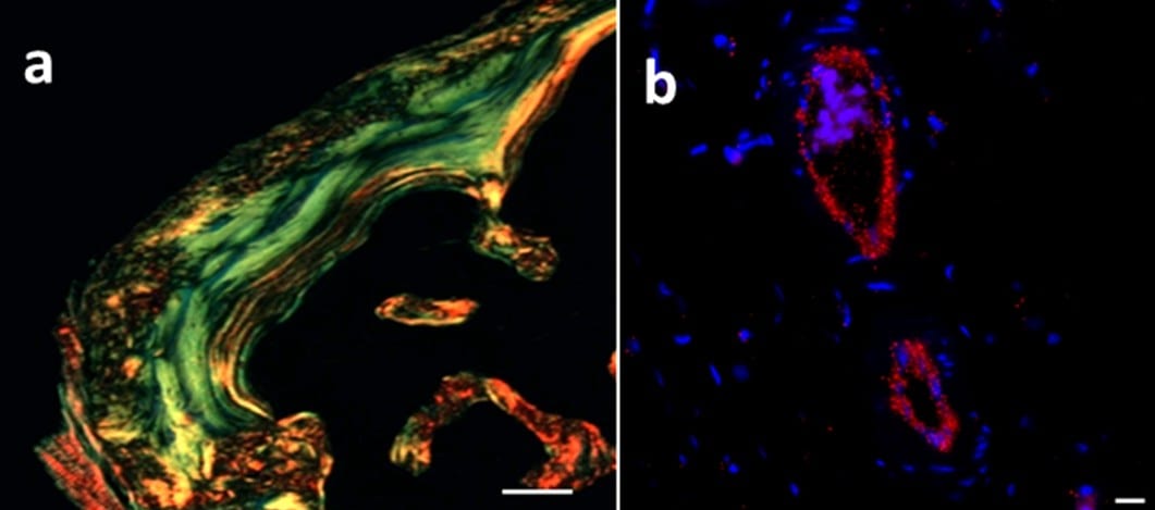 Innovative biomaterials potentiate bone regeneration in the animal model