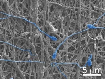 Electrically spun fabric offers dual defense against pregnancy, HIV