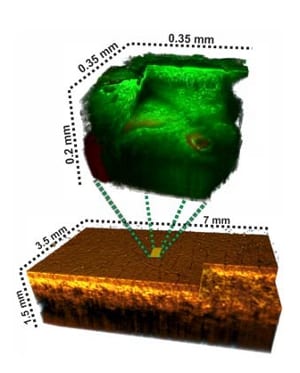 A fruitful combination – two optical processes combine for new 3D skin imaging technique