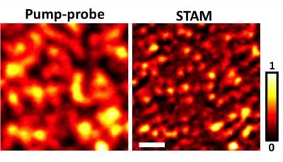 New super-resolution microscopy does not require dyes