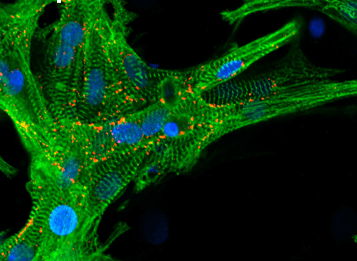 New materials for heart tissue regeneration