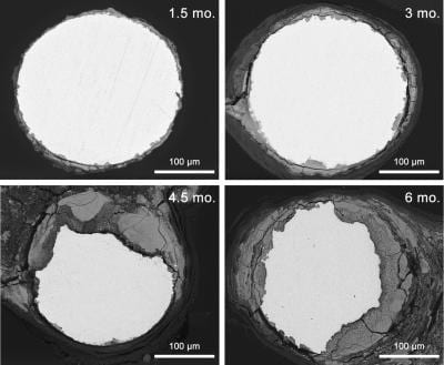 Zinc could be a "golden" bullet for bioabsorbable stents