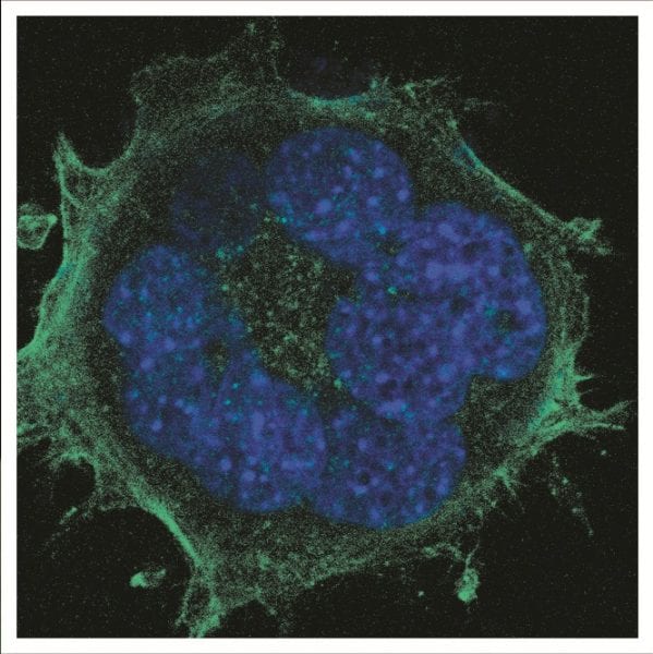 Effects of nanowires on fibroblast dynamics