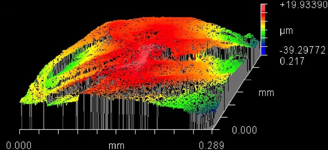 On the path to cartilage regeneration