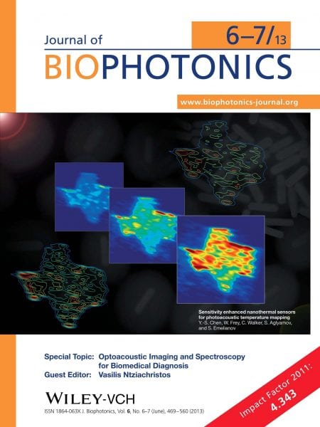 Topical Issue "Optoacoustic Imaging and Spectroscopy for Biomedical Diagnosis"