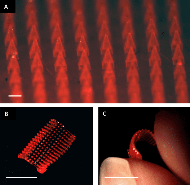 Dissolvable microneedle patches for transdermal drug delivery