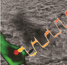 Getting under the skin: hydrogels for monitoring oxygen levels