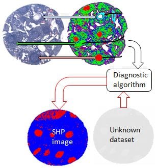 Vibrational molecular pathology