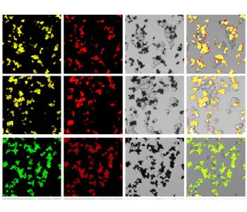 Nanoprobes allow a new kind of cancer detection