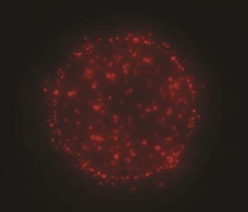 A synergetic pairing: epifluorescent microscopy and electrophoretic microarrays