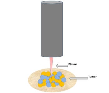 Treating cancer with low temperature plasma