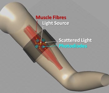 Light sensors for artificial limbs