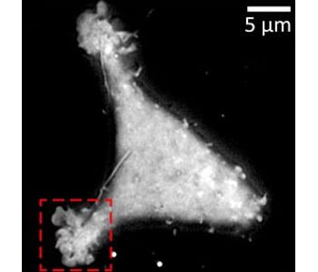 Membranes under observation