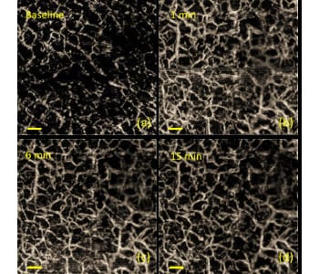 Trapping and watching motile cells