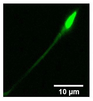 Tracking sperm with confocal laser endomicroscopy