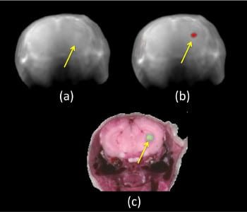 Increased sensitivity of molecular optoacoustic imaging
