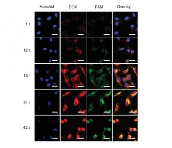 Tumor Prodrug to Monitor Therapeutic Success