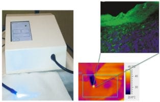 Better healing with blue LEDs