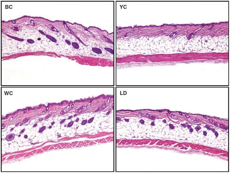 Collagen, The Secret to Anti-Skin-Aging?