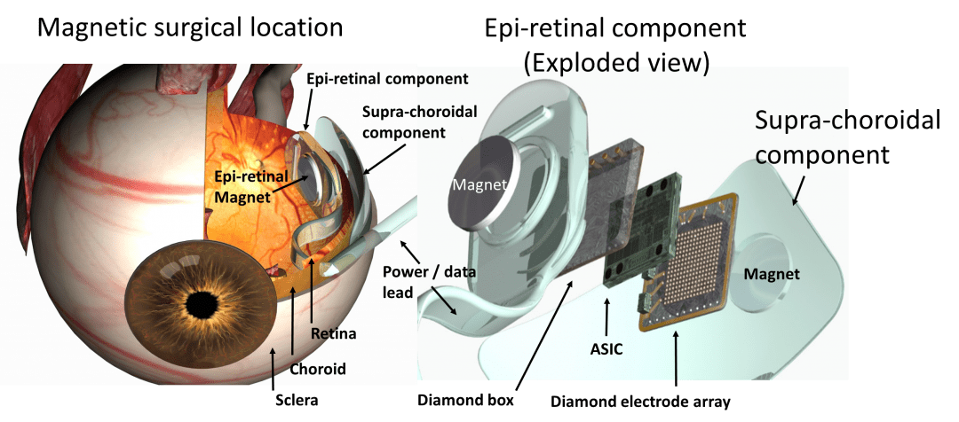 fig2