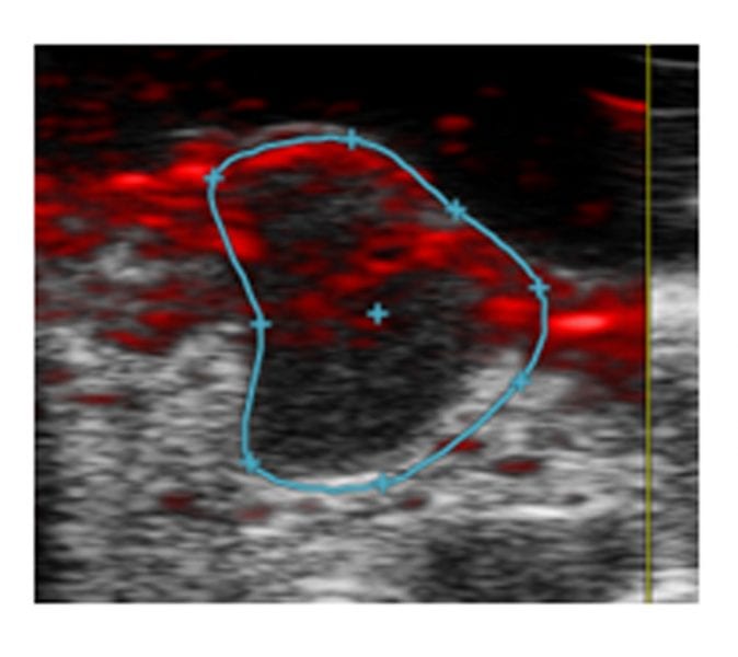 Melanin-Based Nanoparticles for Imaging of Tumor Vasculature