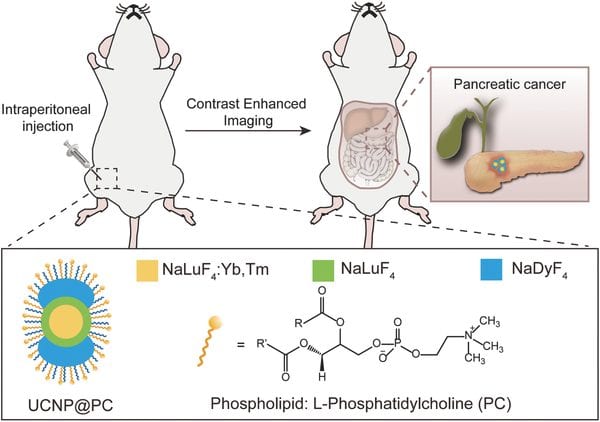 A new route for the diagnosis of pancreatic cancer