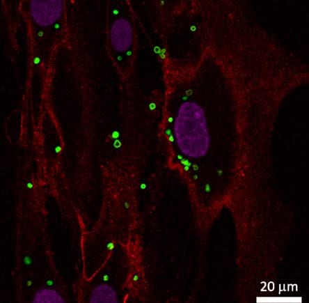 Magnetic Stem Cells for Gene Engineering