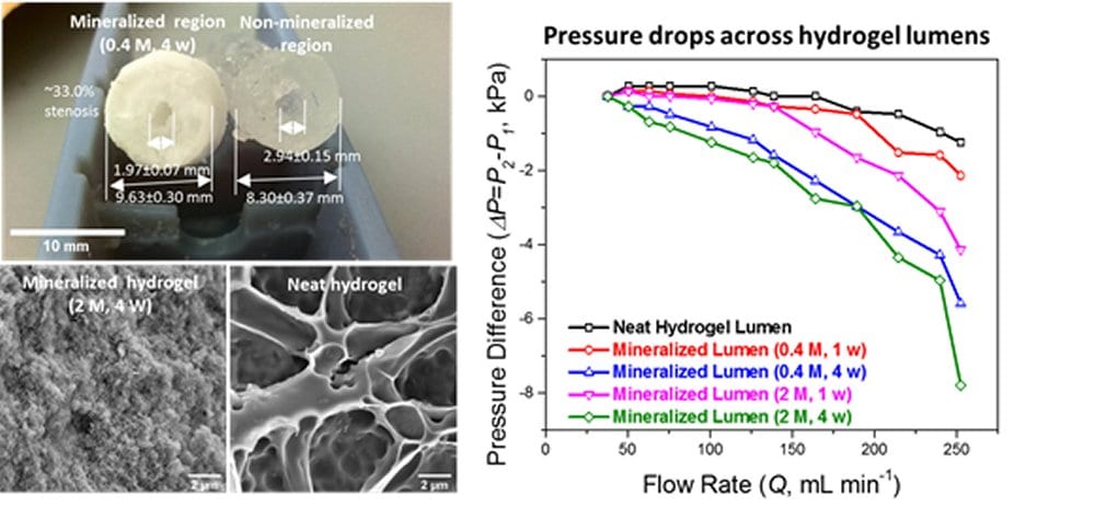 Simulating Arterial Plaque