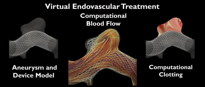 Virtual Endovascular Treatment of Intracranial Aneurysms: Models and Uncertainty
