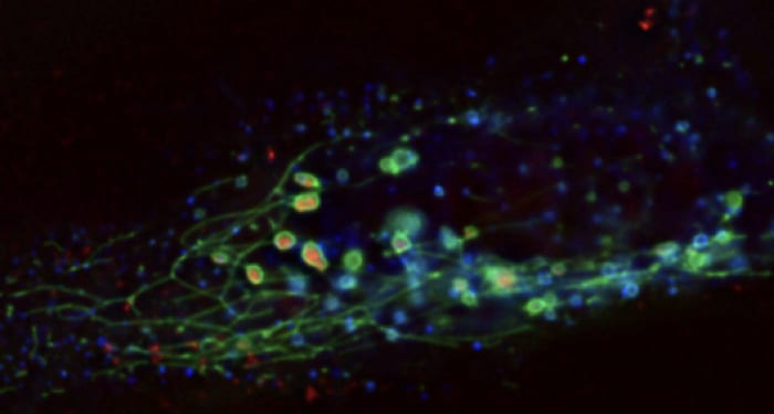 Nanoescapology: Progress toward Understanding the Endosomal Escape of Polymeric Nanoparticles