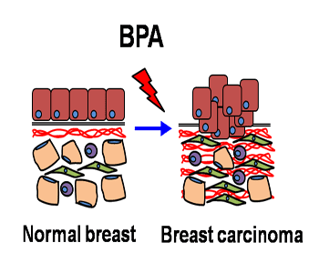 Effect of  Low-Dose Exposure to Bisphenol A on Breast Cancer