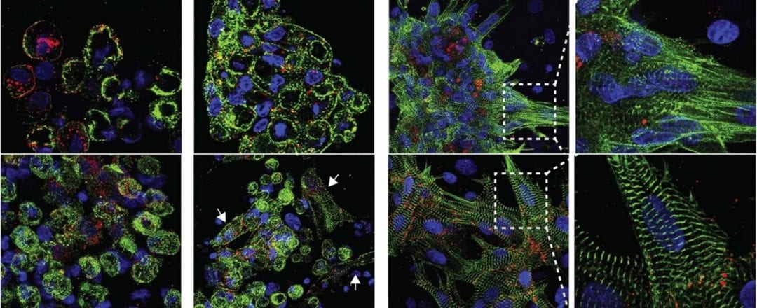 Tissue Engineering with Nanoreinforced Hydrogels for the Uprise of Cyboorganics, Bionics and Biorobotics