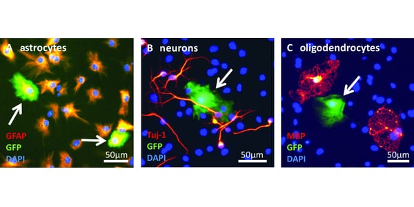 Magnetic Nanoparticle-Mediated Gene Delivery to Neural Stem Cells